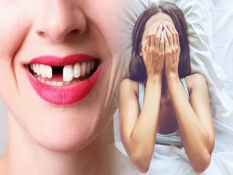 Mơ rụng răng lâu ngày báo hiệu sức khỏe kém