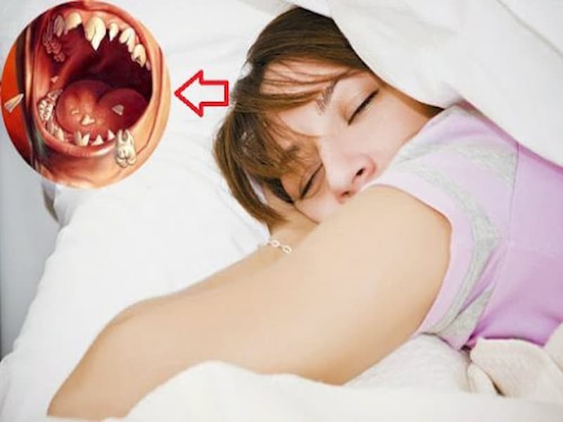 Tùy vào giấc mơ bạn rụng răng gì để đánh số thích hợp